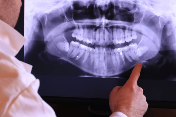 Best Emergency Broken Tooth Repair in Tucson, AZ